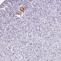 TTLL3 Antibody, Novus Biologicals:Antibodies:Primary Antibodies